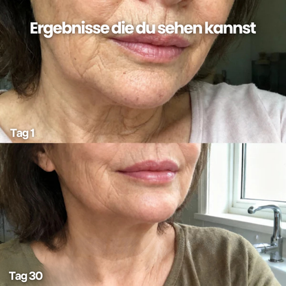 Meliora Calcium Lift Stick – Für sichtbar straffere Haut