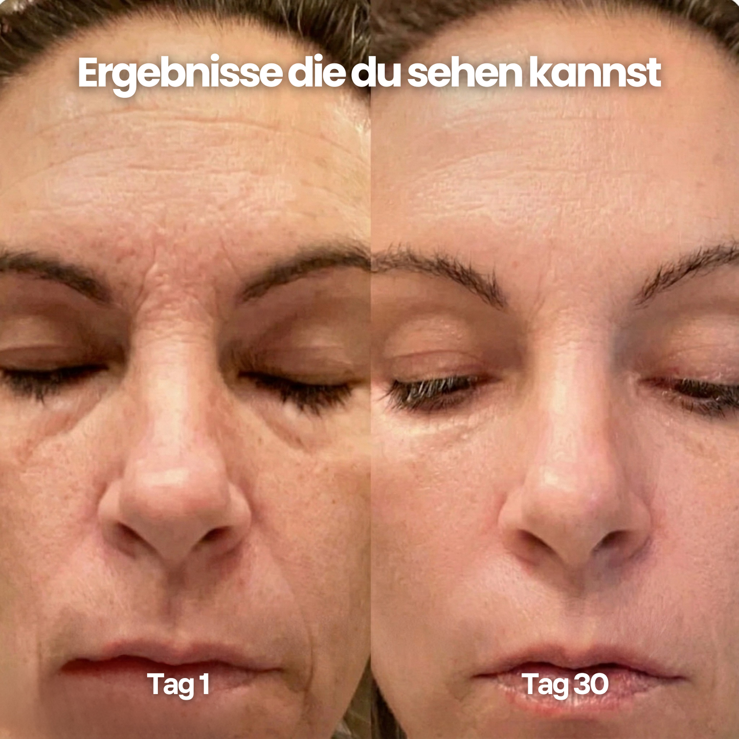 Meliora Calcium Lift Stick – Für sichtbar straffere Haut