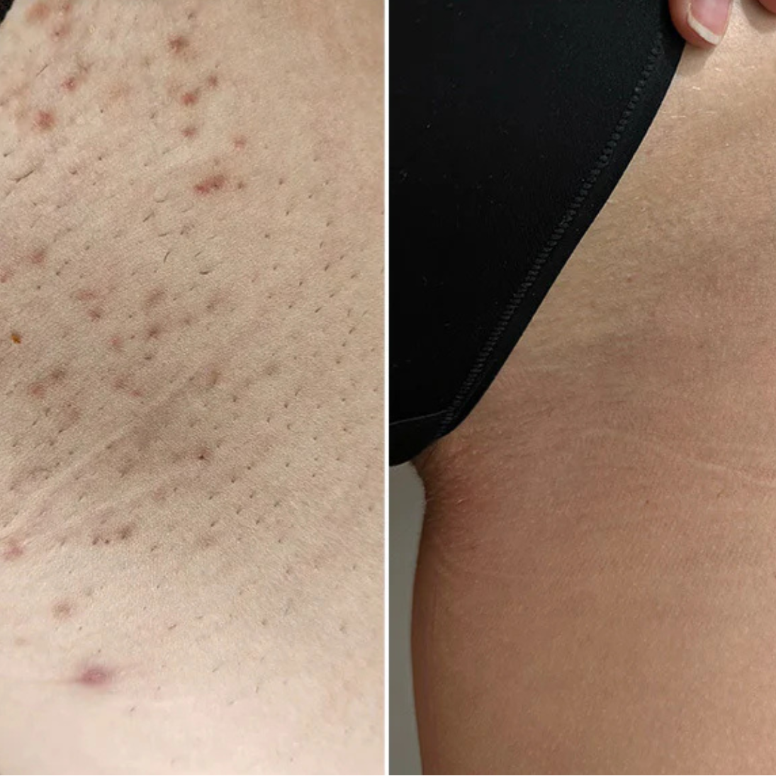 Meliora - Body Peeling Spray