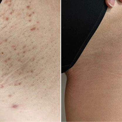 Meliora - Body Peeling Spray